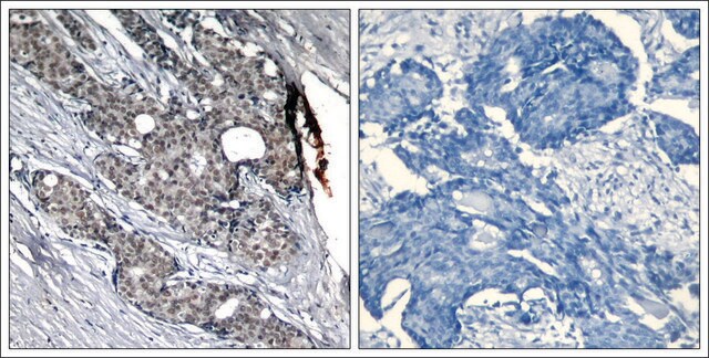 Anti-phospho-TP53 (pSer6) antibody produced in rabbit affinity isolated antibody