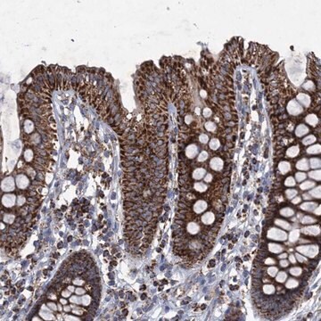 Anti-GTPBP3 antibody produced in rabbit affinity isolated antibody, buffered aqueous glycerol solution