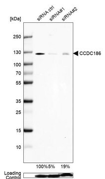 Anti-CCDC186 antibody produced in rabbit Prestige Antibodies&#174; Powered by Atlas Antibodies, affinity isolated antibody, buffered aqueous glycerol solution