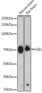 Anti-LGI1 Antibody, clone 2P8Z9, Rabbit Monoclonal