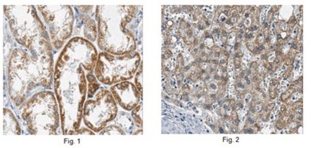 Anti-Mitochondrial dicarboxylate carrier Antibody, clone 1F5.1 clone 1F5.1, from mouse