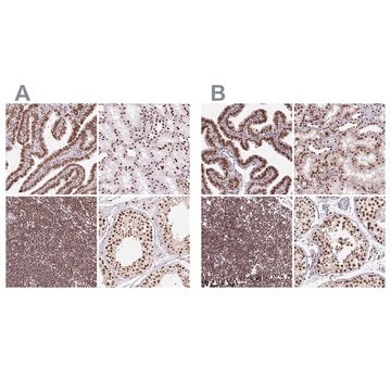 Anti-XRCC6 antibody produced in rabbit Prestige Antibodies&#174; Powered by Atlas Antibodies, affinity isolated antibody, buffered aqueous glycerol solution