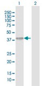 Anti-ACAD8 antibody produced in rabbit purified immunoglobulin, buffered aqueous solution