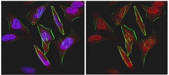 Anti-FOXC1 Antibody from rabbit, purified by affinity chromatography