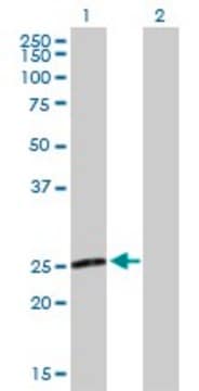 Anti-NXNL1 antibody produced in mouse purified immunoglobulin, buffered aqueous solution