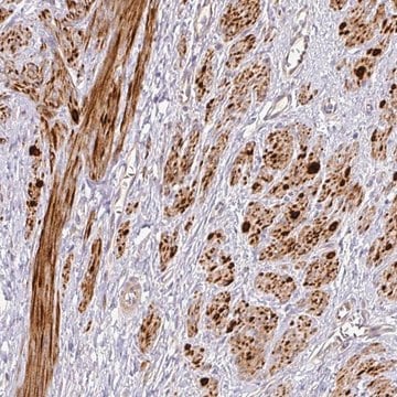 Anti-TARM1 antibody produced in rabbit Prestige Antibodies&#174; Powered by Atlas Antibodies, affinity isolated antibody, buffered aqueous glycerol solution