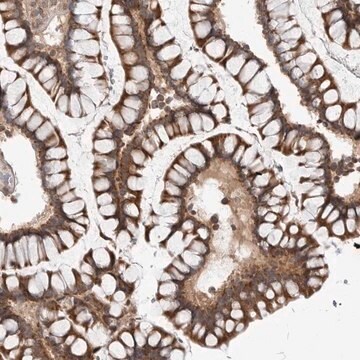 Anti-CCDC18 antibody produced in rabbit Prestige Antibodies&#174; Powered by Atlas Antibodies, affinity isolated antibody, buffered aqueous glycerol solution