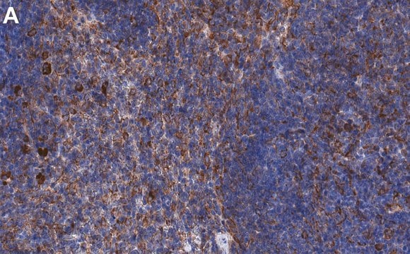 Anti-IL-17A Antibody, clone 3K22 ZooMAb&#174; Rabbit Monoclonal recombinant, expressed in HEK 293 cells