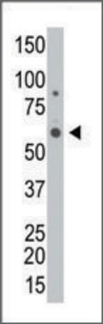 Anti-GALK2 (C-term) antibody produced in rabbit IgG fraction of antiserum, buffered aqueous solution