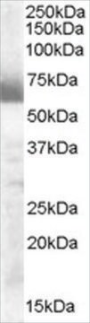 Anti-CYP17A1 antibody produced in goat affinity isolated antibody, buffered aqueous solution