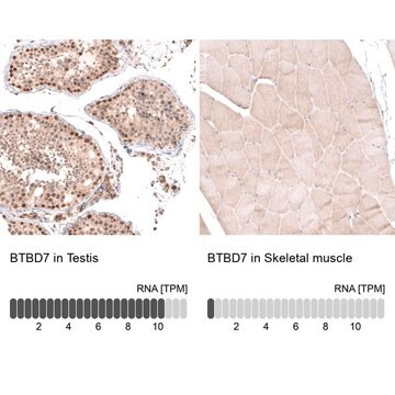 Anti-BTBD7 antibody produced in rabbit Prestige Antibodies&#174; Powered by Atlas Antibodies, affinity isolated antibody, buffered aqueous glycerol solution