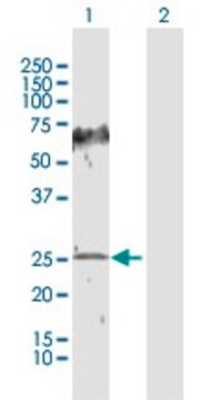 Anti-HPGD antibody produced in rabbit purified immunoglobulin, buffered aqueous solution