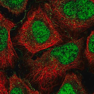 Anti-GPCPD1 antibody produced in rabbit Prestige Antibodies&#174; Powered by Atlas Antibodies, affinity isolated antibody