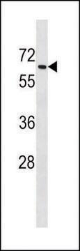 ANTI-MOUSE TGFBR2 (C-TERM) antibody produced in rabbit IgG fraction of antiserum, buffered aqueous solution