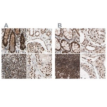 Anti-CHAMP1 antibody produced in rabbit Prestige Antibodies&#174; Powered by Atlas Antibodies, affinity isolated antibody, buffered aqueous glycerol solution