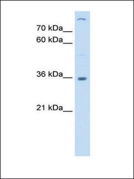 Anti-LMAN2 (AB2) antibody produced in rabbit affinity isolated antibody