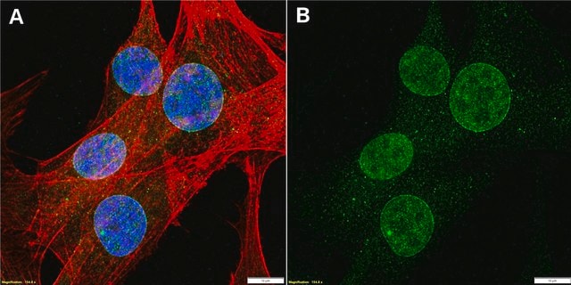 Anti-Nesprin-2/SYNE2