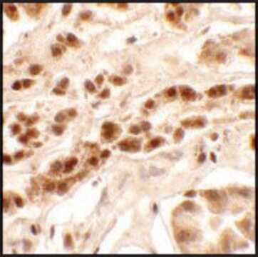 Anti-PTCHD2 antibody produced in rabbit affinity isolated antibody