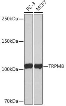 Anti-TRPM8 Antibody, clone 9S8N1, Rabbit Monoclonal