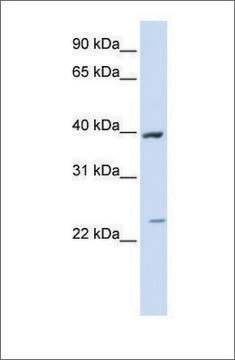 Anti-ACADL antibody produced in rabbit affinity isolated antibody