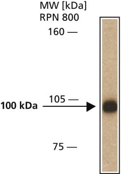 抗iASPP抗体，小鼠单克隆抗体 clone LXO49.3, purified from hybridoma cell culture