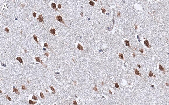 Anti-NOVA2 Antibody, clone 2J16 ZooMAb&#174; Rabbit Monoclonal recombinant, expressed in HEK 293 cells