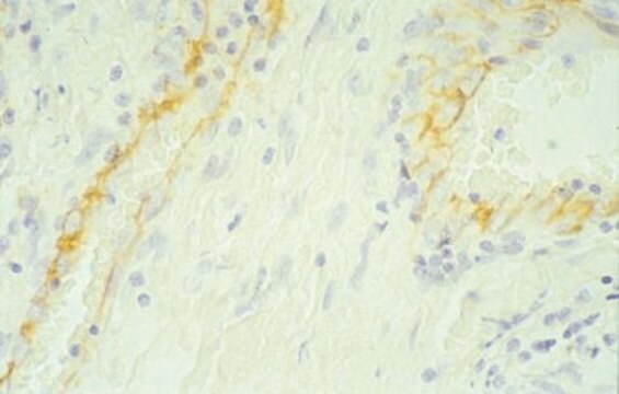 Anti-PECAM-1 Antibody, domains 3-6 of human PECAM-1, clone HC1/6 clone HC1/6, Chemicon&#174;, from mouse