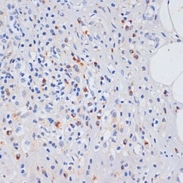 Anti-TLR4 antibody produced in rabbit