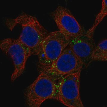 Anti-Snx2 Antibody Produced In Rabbit Prestige Antibodies&#174; Powered by Atlas Antibodies, affinity isolated antibody, buffered aqueous glycerol solution