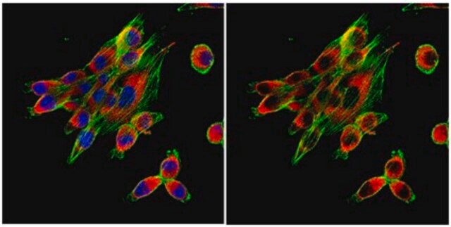 Anticorps anti-calnexine from rabbit, purified by affinity chromatography