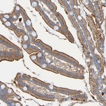 Anti-C11orf24 antibody produced in rabbit Prestige Antibodies&#174; Powered by Atlas Antibodies, affinity isolated antibody, buffered aqueous glycerol solution