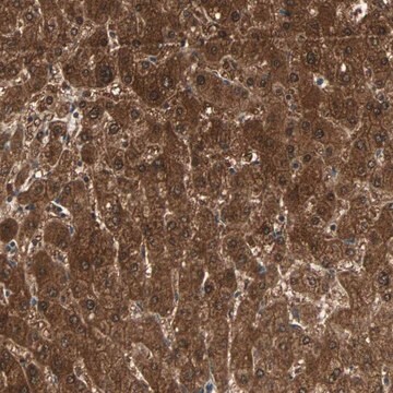 Anti-ZSCAN31 antibody produced in rabbit Prestige Antibodies&#174; Powered by Atlas Antibodies, affinity isolated antibody, buffered aqueous glycerol solution