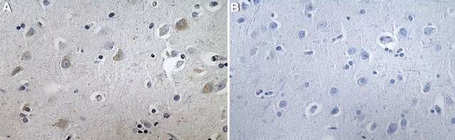 Anti-LNPEP/IRAP Antibody, clone 1G23 ZooMAb&#174; Rabbit Monoclonal recombinant, expressed in HEK 293 cells