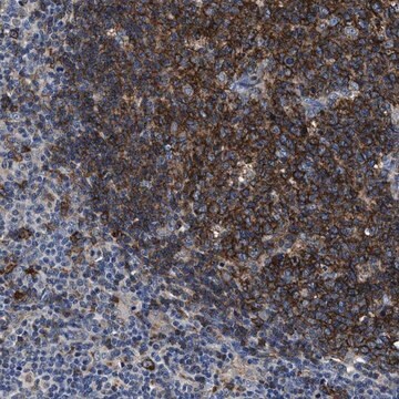 Anti-C2orf66 antibody produced in rabbit Prestige Antibodies&#174; Powered by Atlas Antibodies, affinity isolated antibody, buffered aqueous glycerol solution