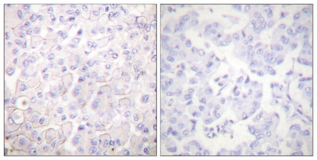 Anti-Cadherin-pan antibody produced in rabbit affinity isolated antibody