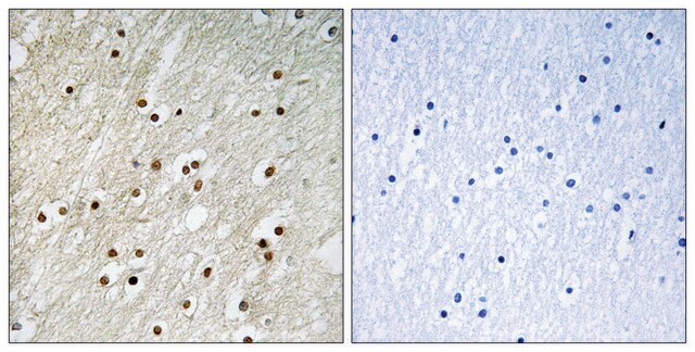 Anti-KU70 antibody produced in rabbit affinity isolated antibody