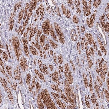 Anti-TOMM40L antibody produced in rabbit Prestige Antibodies&#174; Powered by Atlas Antibodies, affinity isolated antibody, buffered aqueous glycerol solution