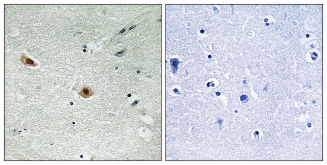 Anti-phospho-Retinoblastoma (pSer608) antibody produced in rabbit affinity isolated antibody