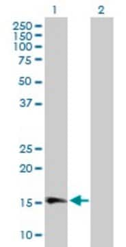 Anti-GPLD1 antibody produced in mouse purified immunoglobulin, buffered aqueous solution