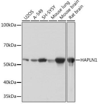 Anti-HAPLN1 Antibody, clone 5O9U2, Rabbit Monoclonal