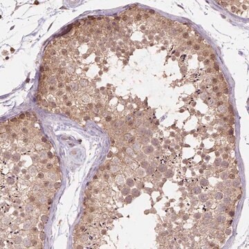 Anti-NUDT10 antibody produced in rabbit Prestige Antibodies&#174; Powered by Atlas Antibodies, affinity isolated antibody, buffered aqueous glycerol solution