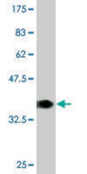 Monoclonal Anti-FMR1 antibody produced in mouse clone 3E11, purified immunoglobulin, buffered aqueous solution