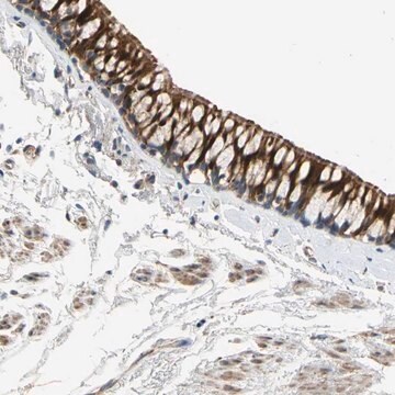 Anti-FAM189B antibody produced in rabbit Prestige Antibodies&#174; Powered by Atlas Antibodies, affinity isolated antibody, buffered aqueous glycerol solution