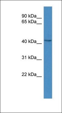 Anti-BCAT1 antibody produced in rabbit affinity isolated antibody