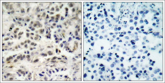 Anti-CDKN1B (Ab-10) antibody produced in rabbit affinity isolated antibody