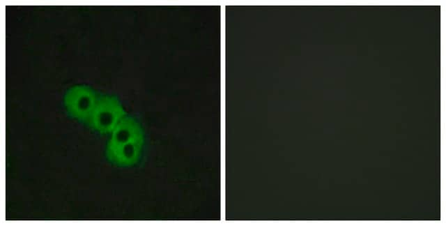 Anti-GPR109 antibody produced in rabbit affinity isolated antibody