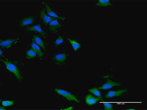 Monoclonal Anti-PLXNB2 antibody produced in mouse clone 2H3, purified immunoglobulin, buffered aqueous solution