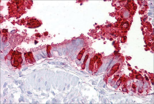 Anti-SCGB1A1 antibody produced in rabbit affinity isolated antibody