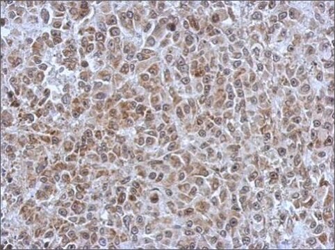 Anti-POM121 antibody produced in rabbit affinity isolated antibody, buffered aqueous solution