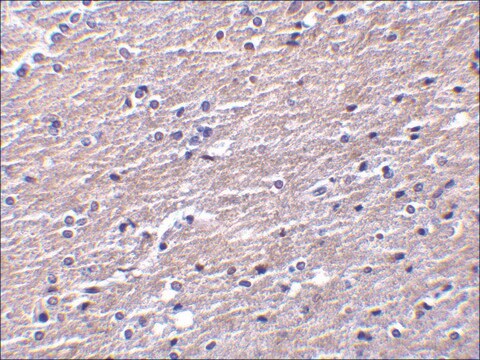 Anti-Clusterin antibody produced in rabbit affinity isolated antibody, buffered aqueous solution